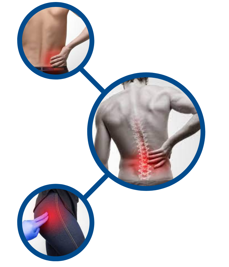 Illustration of back pain symptoms, featuring three individuals: one holding their lower back in pain, another showing discomfort in the mid-back, and a third with a hand on their hip, highlighting hip pain, emphasizing common joint pain issues related to hip and back discomfort.