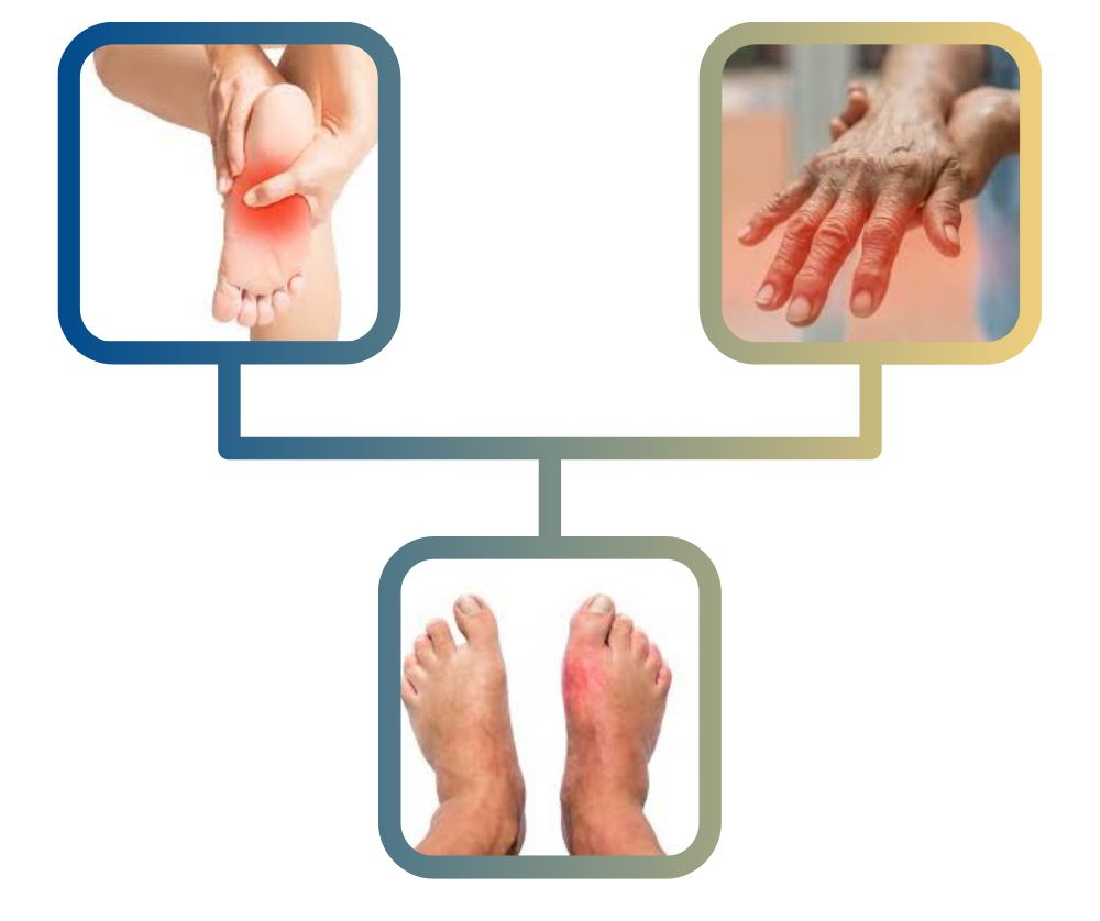 Illustration depicting symptoms of peripheral neuropathy, including a person holding their foot in pain, a close-up of a hand with discomfort, and feet showing signs of redness, highlighting common issues related to nerve damage and pain management.
