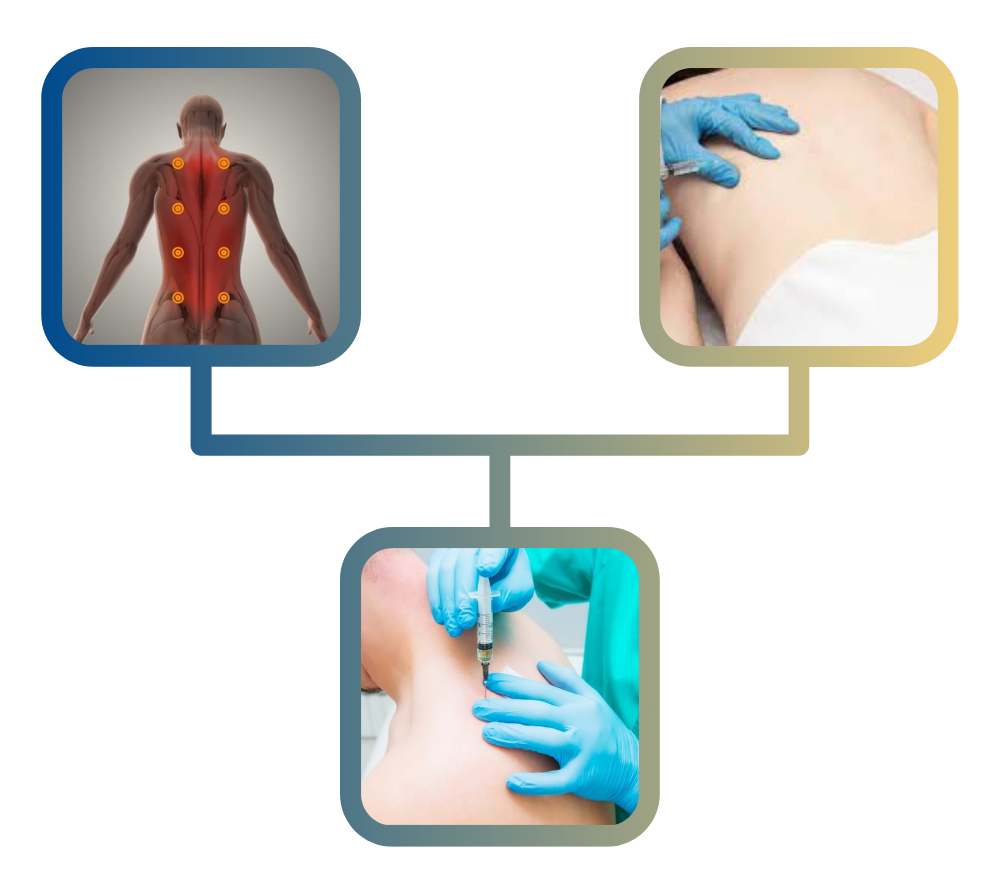 Illustration depicting trigger points on a human back, with images of a healthcare professional administering a trigger point injection, emphasizing pain relief through targeted muscle treatment.