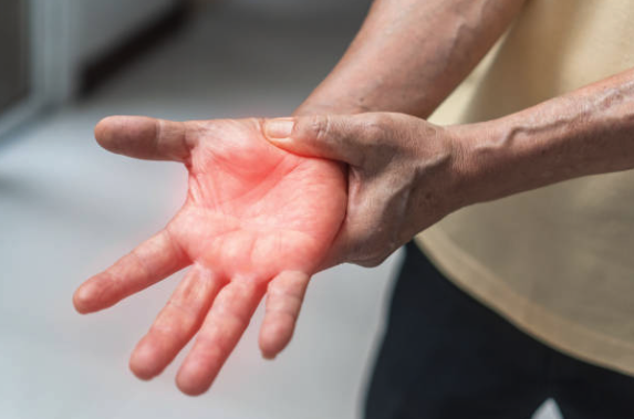 Person experiencing discomfort in their hand, highlighting symptoms of peripheral neuropathy, relevant to regenerative treatment discussions.